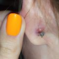 Piercing - Problem z kolczykiem