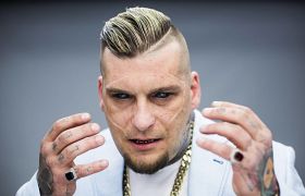 Tatuowanie gałki ocznej